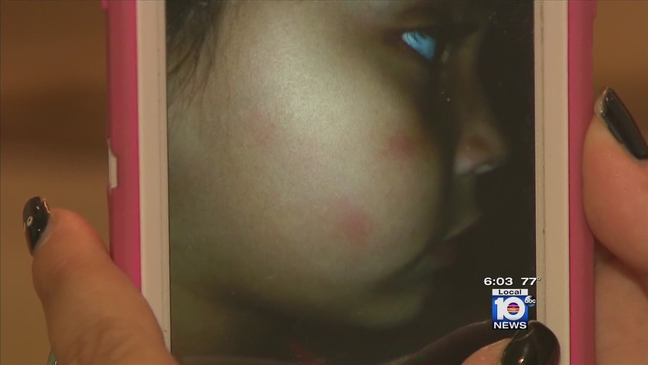 Bed Bugs Miami South Beach Bed Bugs Miami South Beach